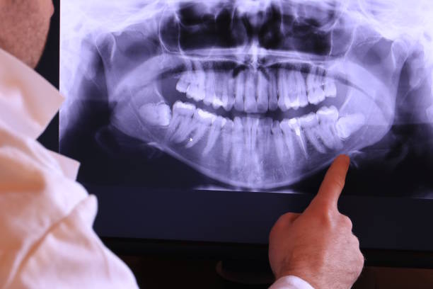 Best Dental Abscess Treatment in Salem, IN